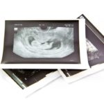 Samen Zwanger – Echo en Pretecho 3