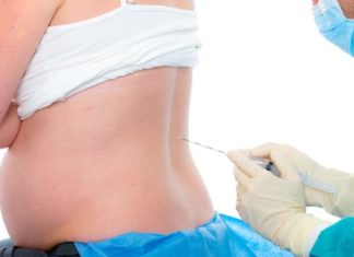 Ruggenprik Samen Zwanger - Ruggenprik