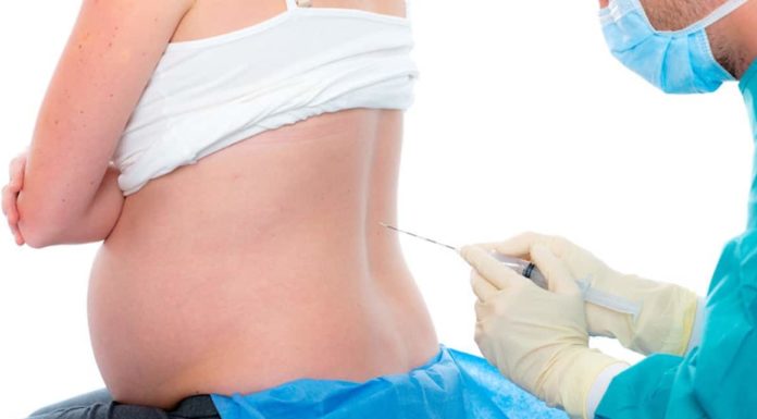 Ruggenprik Samen Zwanger - Ruggenprik