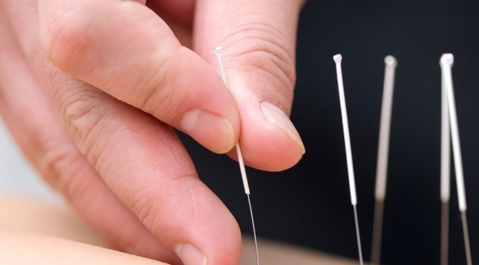 Acupunctuur Samen Zwanger - Acupunctuur