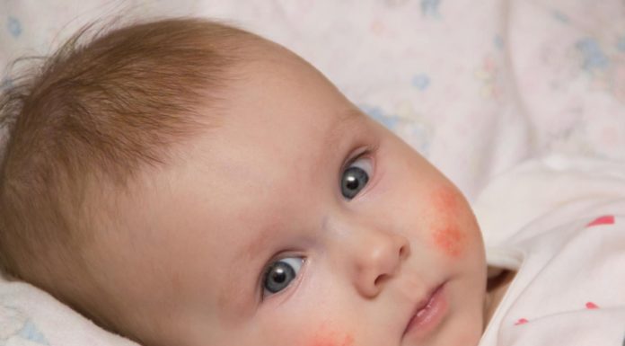 Allergieën Samen Zwanger - Allergieën