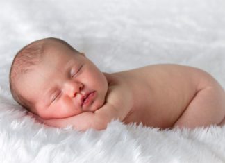 Geboortevlekken: Ooievaarsbeet, wijnvlekken etc. Samen Zwanger - Geboortevlekken Ooievaarsbeet, café au lait vlekken, mongolenvlekken