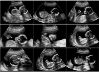 Geboortezorg is óók zorg voor moeders Samen Zwanger - Geboortezorg is óók zorg voor moeders