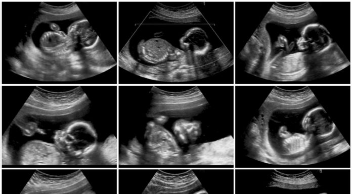 Geboortezorg is óók zorg voor moeders Samen Zwanger - Geboortezorg is óók zorg voor moeders