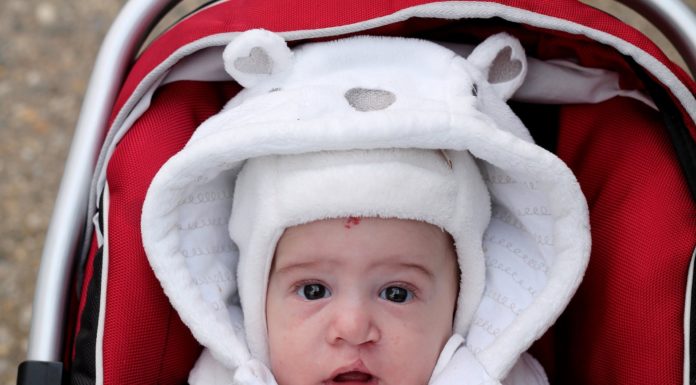 Hazenlip (schisis) Samen Zwanger - Hazenlip (schisis)