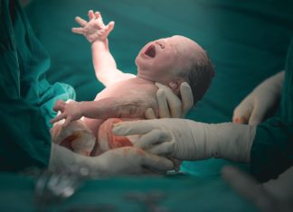 De keizersnede Samen Zwanger - Keizersnede