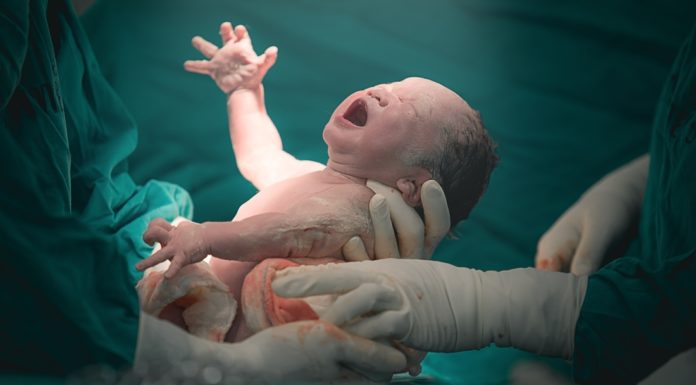 De keizersnede Samen Zwanger - Keizersnede