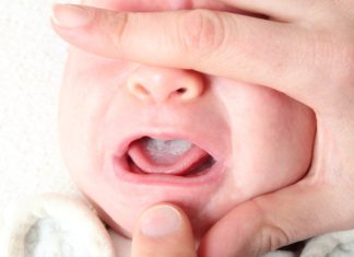 Spruw bij baby Samen Zwanger - Spruw bij baby