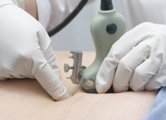 Vruchtwaterpunctie Samen Zwanger - Vruchtwaterpunctie