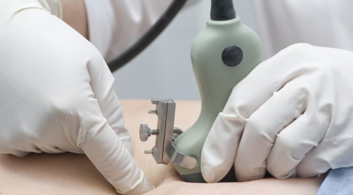 Vruchtwaterpunctie Samen Zwanger - Vruchtwaterpunctie