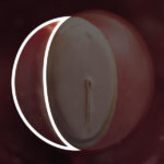 Samen Zwanger _ 4 weken zwanger – trimester 1 week 4 foto (3)