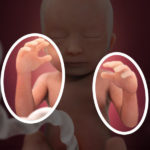 SamenZwanger_18wekenzwanger_600x600_2