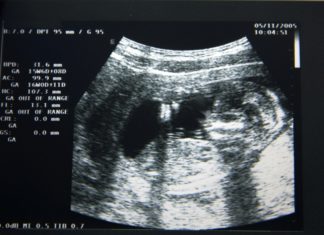 Hilarische echo: ‘Ik dacht dat ik zwanger was van een vogel’ Samen Zwanger - 'Ik dacht dat ik zwanger was van een vogel'