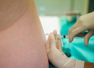 Ruggenprik bij bevalling of niet? Grote verschillen per provincie Samen Zwanger - Ruggenprik