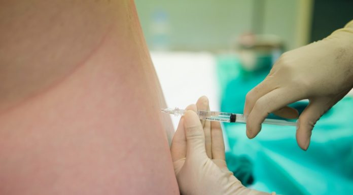 Ruggenprik bij bevalling of niet? Grote verschillen per provincie Samen Zwanger - Ruggenprik