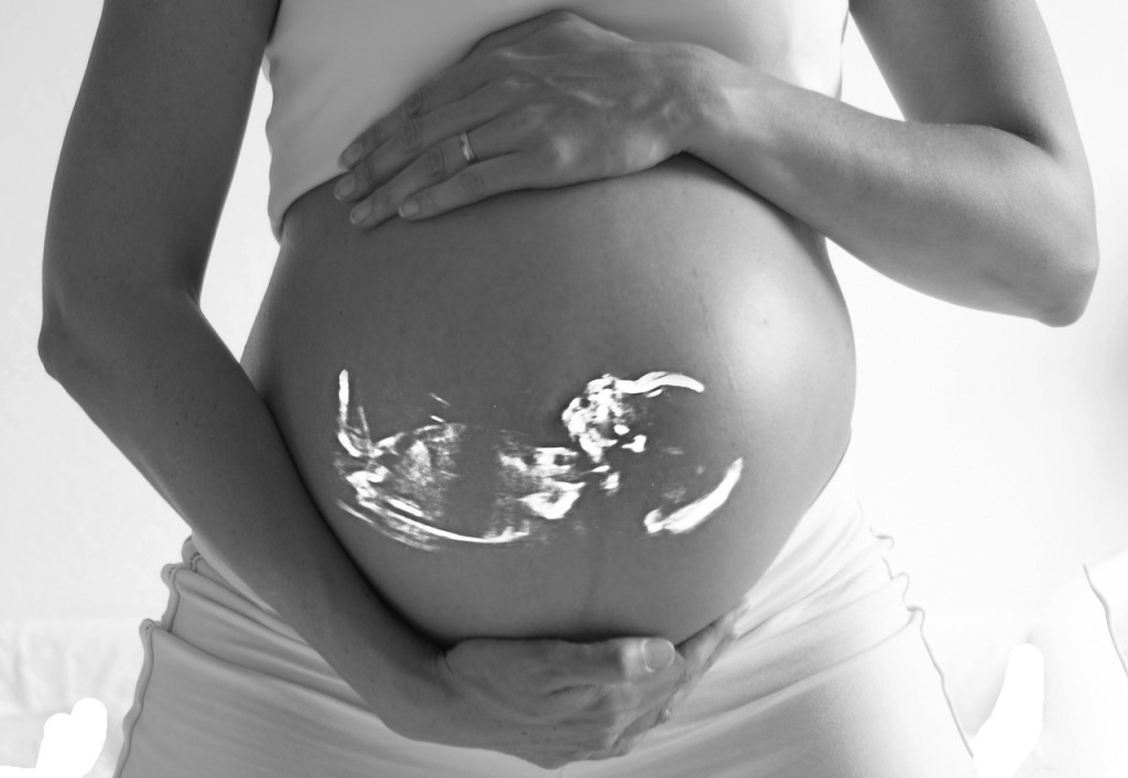 Samen Zwanger - Zwangere vrouwen willen vaker een echo