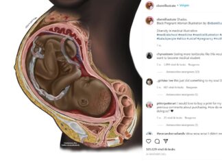 Tekening van zwarte foetus massaal gedeeld Samen Zwanger - zwarte foetus